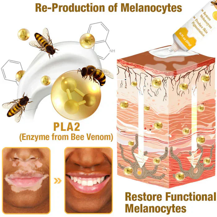 VitiGO™ Bee Venom Corrector Cream